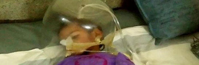 “Sabal” rescued Nandini from malnutrition